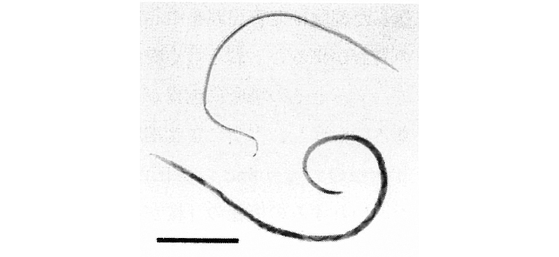 Angiostrongylus cantonensis(広東住血線虫)