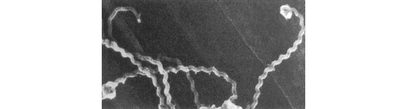 レプトスピラの電子顕微鏡像